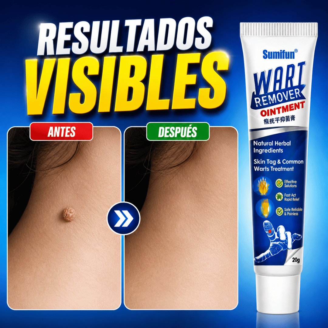 Pomada Wart Remover Sumifun 20g - Remueve verrugas desde la raíz de forma segura en casa