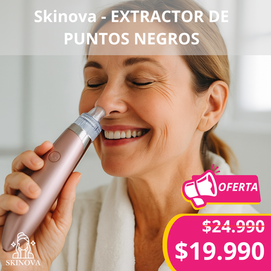 Skinova - Extractor de puntos negros