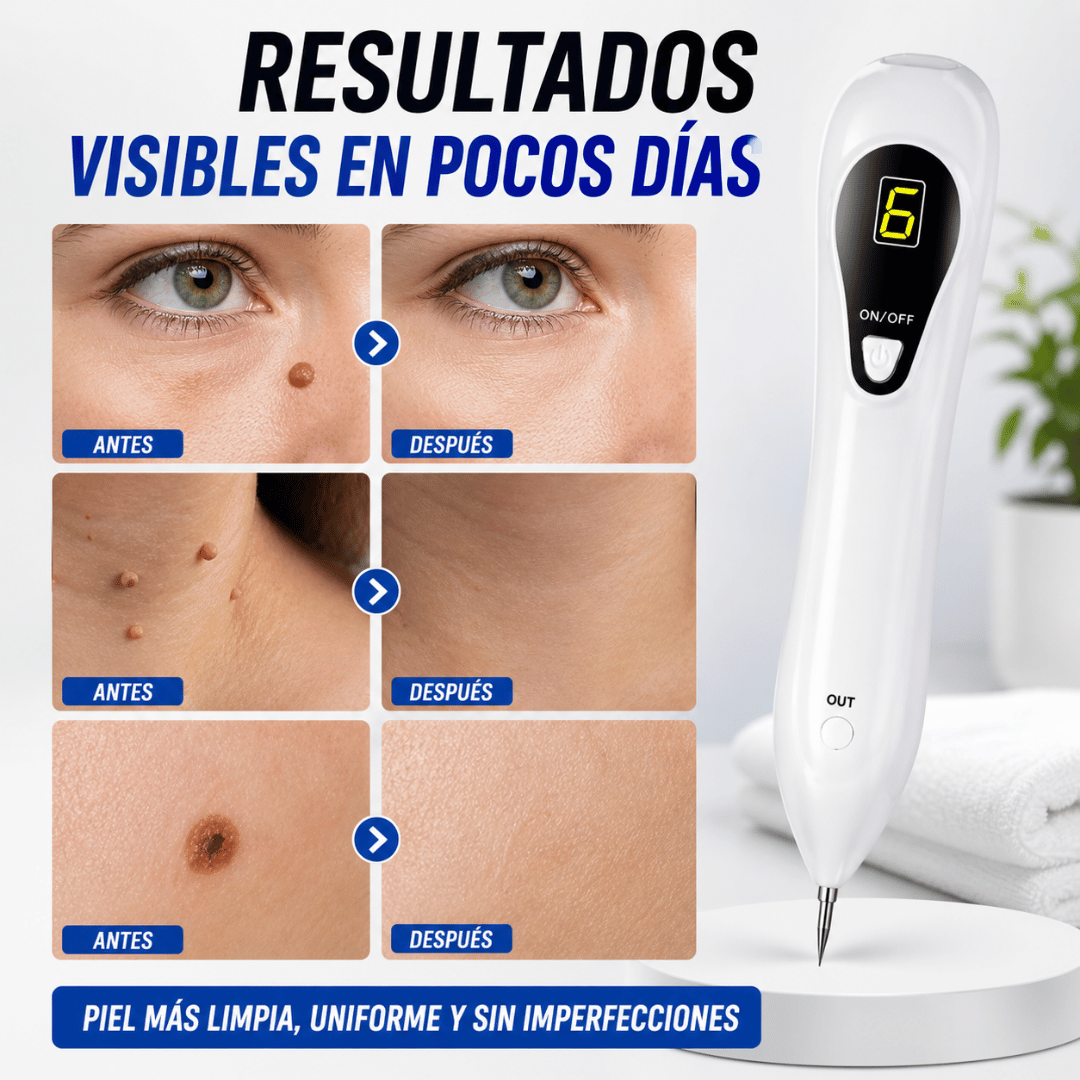 Nevus Pen - Quita verrugas de forma eficaz sin tratamientos costosos