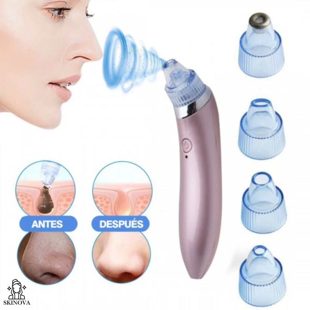 Skinova - Extractor de puntos negros